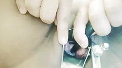 Thai milf inserts tube deep in her cervix