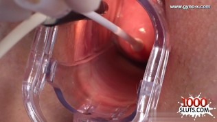 Cute pussy accidental insemination