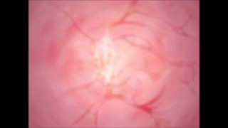 Pretty Pridot Complete