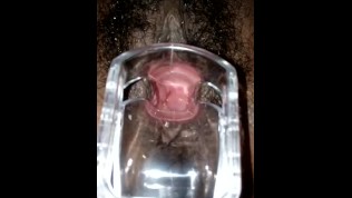 SLIM INDIAN GIRL VAGINA CERVIX SPECULUM.mp4